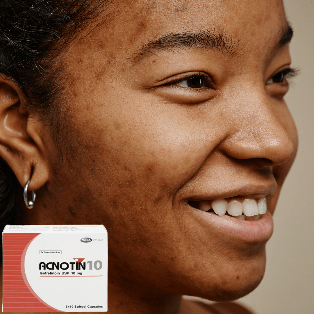 Look Alyfe Acnotin 10 Isotretinoin Severe Acne Treatment Capsule - 10mg