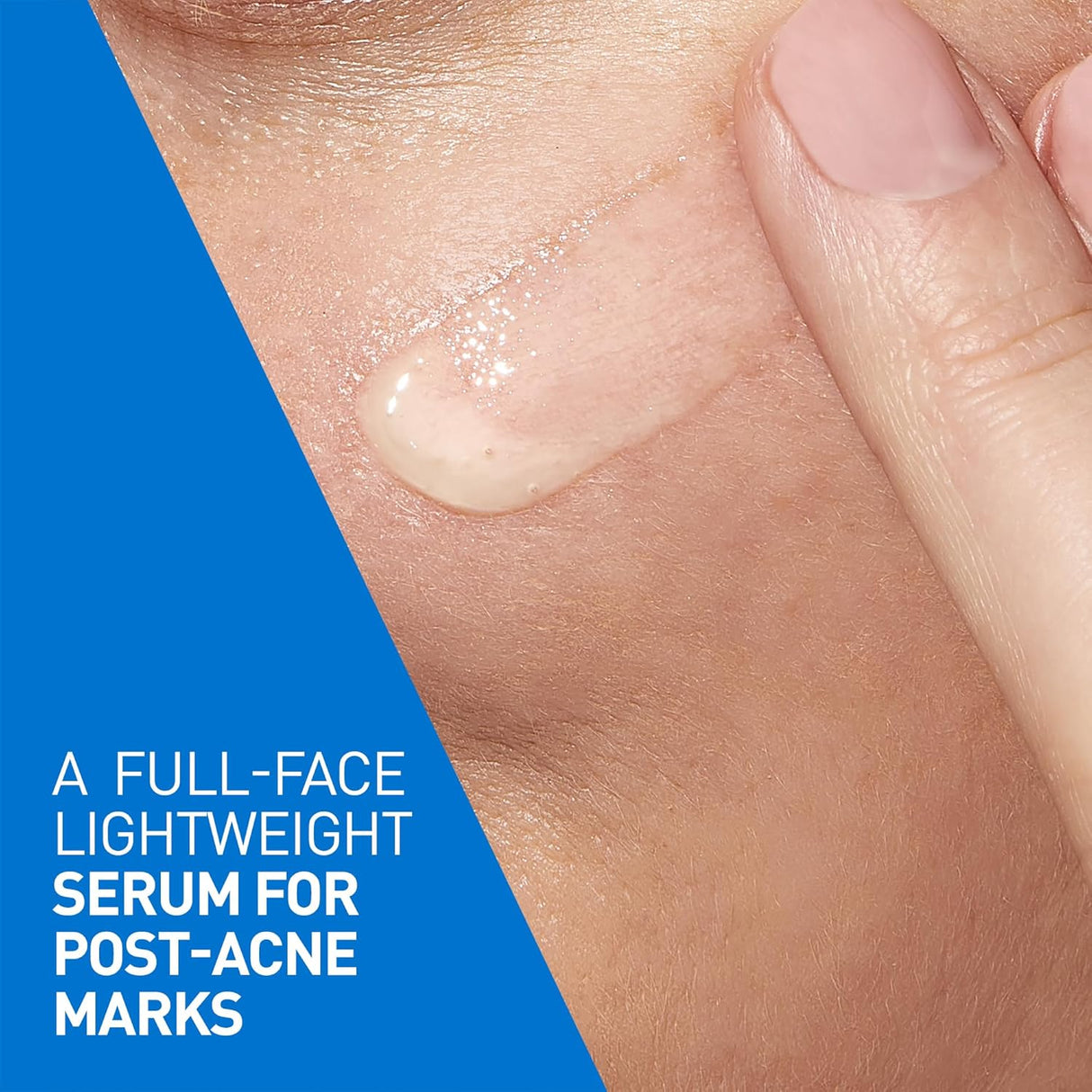 Look Alyfe CeraVe Resurfacing Retinol Serum with Ceramides and Niacinamide for Blemish-Prone Skin - 30ml