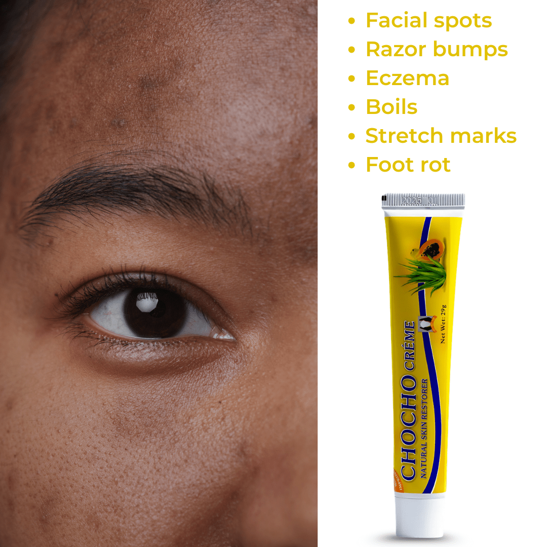 Look Alyfe Chocho Natural Skin Restorer Cream - 29g