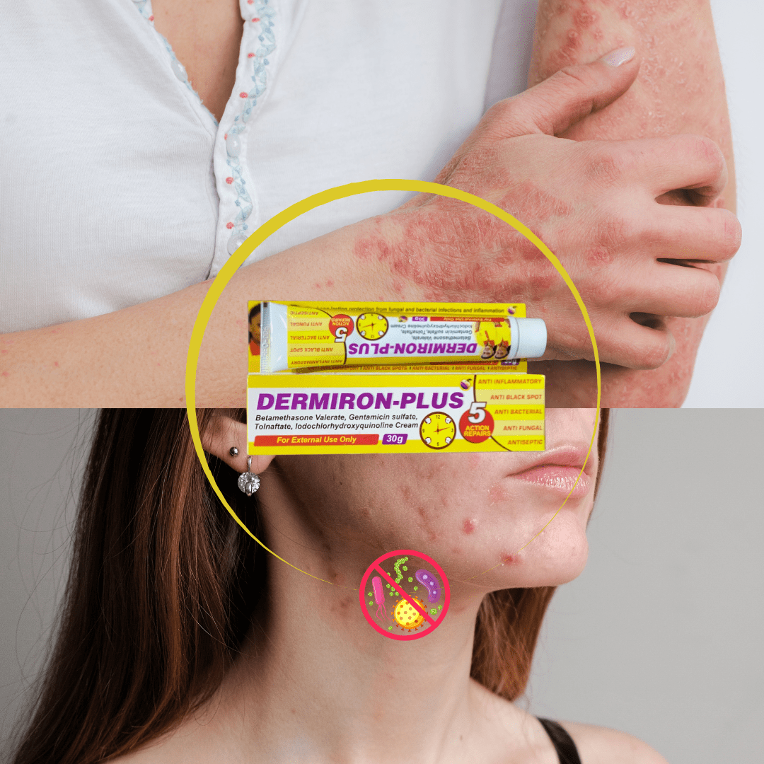 Look Alyfe Dermiron Plus Tripple Action Cream - 30g