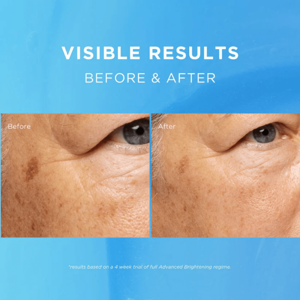 Look Alyfe Fade Out Advanced Brightening Day Cream with SPF20 - 50ml