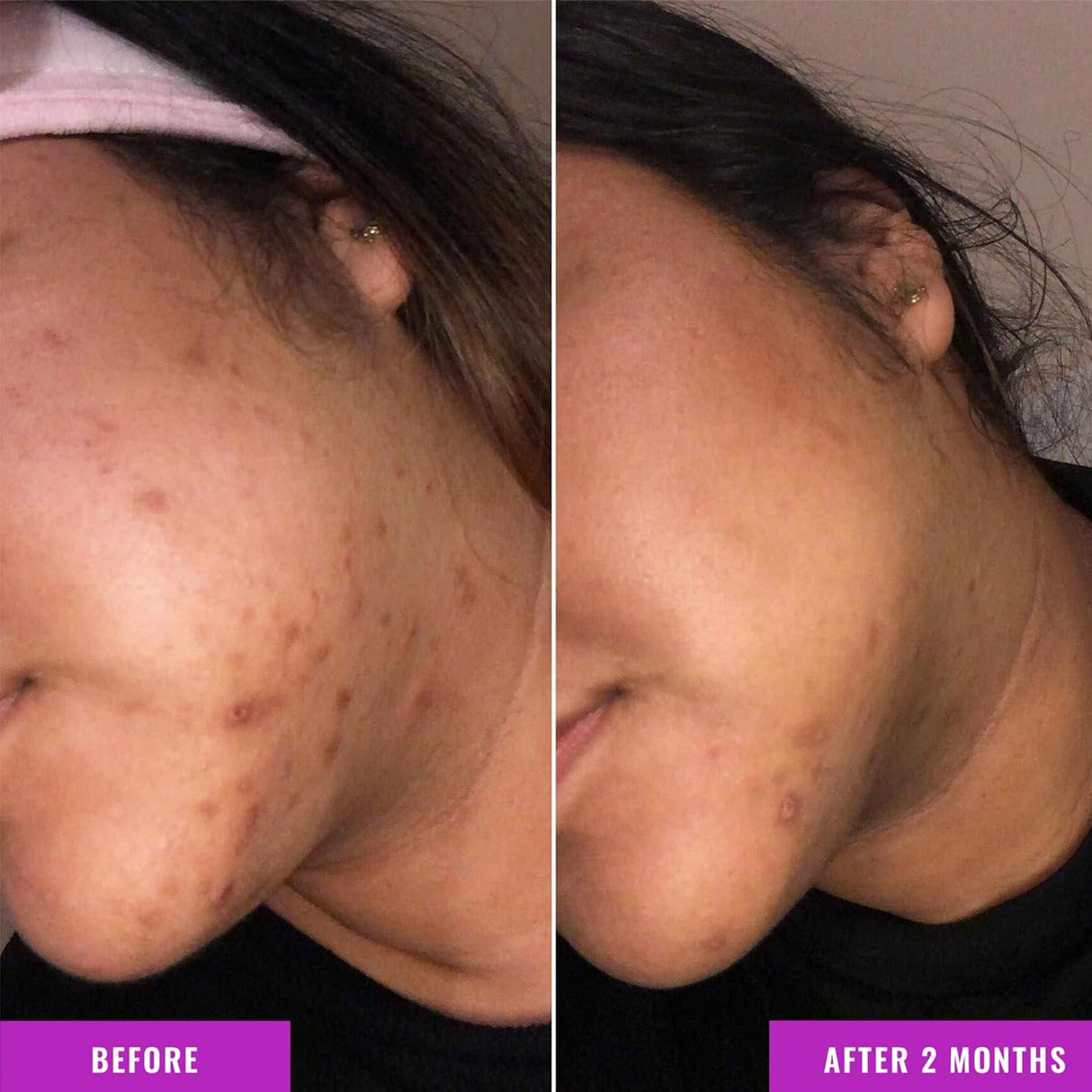 Look Alyfe Good Molecules Discoloration Correcting Serum - 30ml