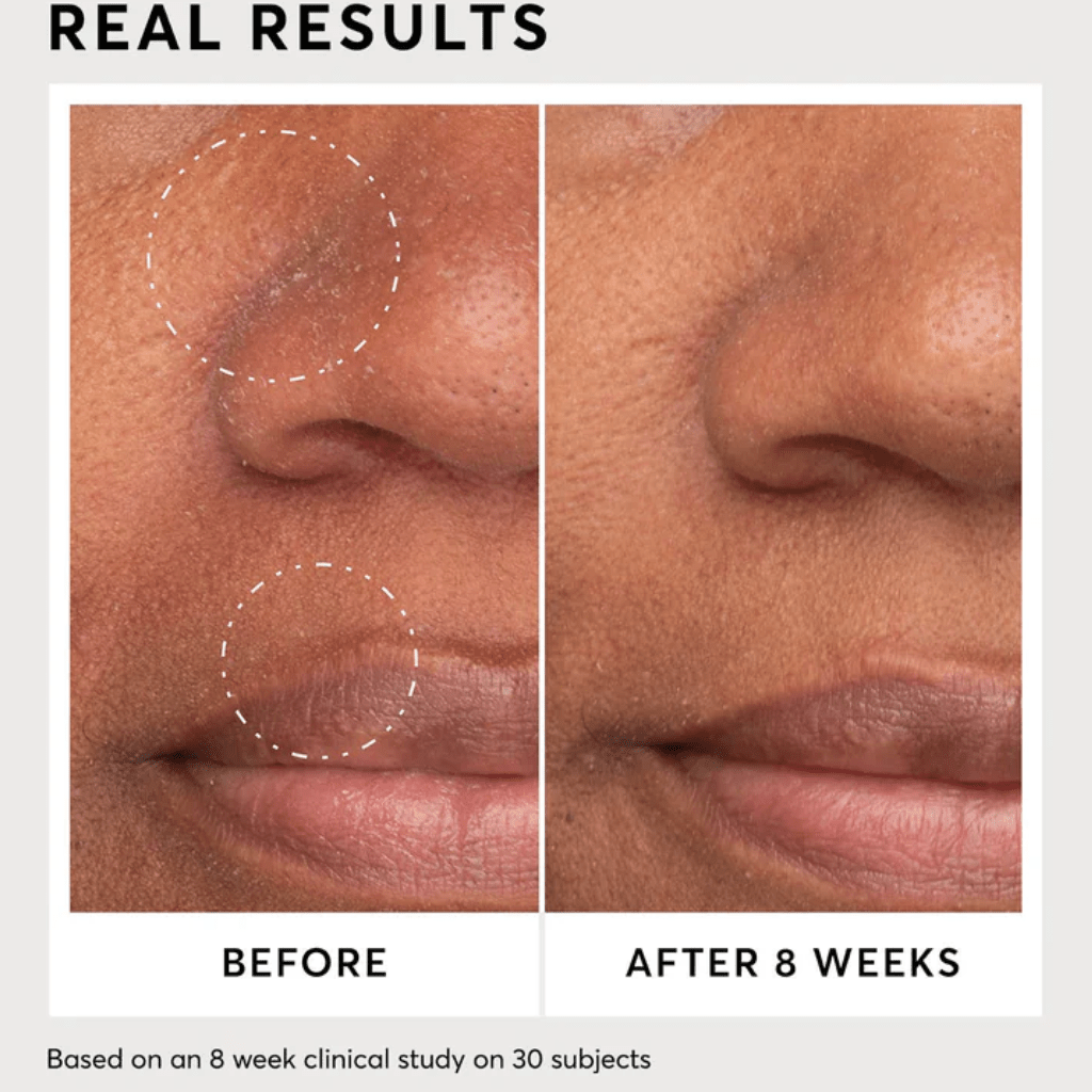 Look Alyfe Naturium Niacinamide Serum 12% Plus Zinc 2% - 30ml