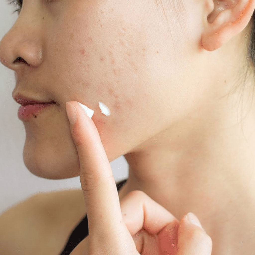 Look Alyfe Pyunkang Yul Acne Cream - 500ml