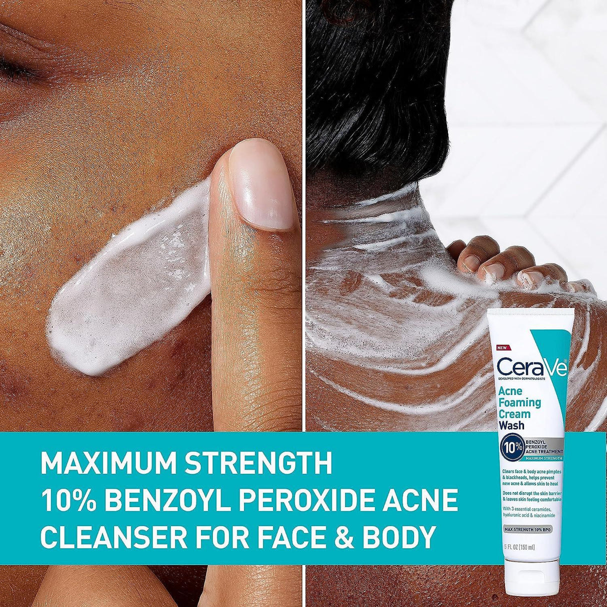 Look Alyfe Cerave Acne Foaming Cream Wash with 10% BPO For Face And Body - 150ml