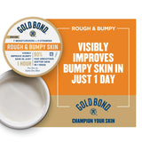 Look Alyfe Gold Bond Rough & Bumpy Daily Skin Therapy Cream - 226g